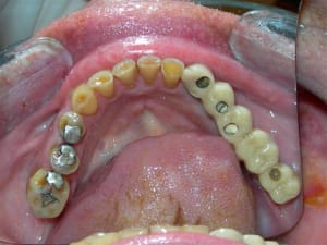 Rscn1878 jgrdim - Eugenol