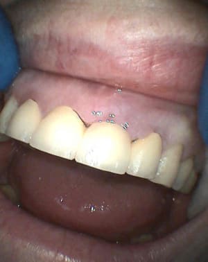 S29 gjnffe - Eugenol