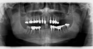 Ss1 wlgh71 - Eugenol