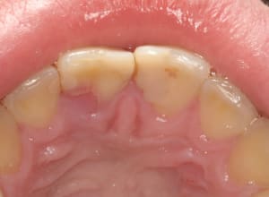Sans titre bpmtrg - Eugenol