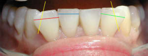 Strip1 yqselq - Eugenol