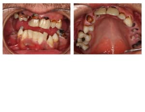 Untitled at2wt2 - Eugenol