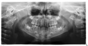 Vardanyan a 20120419 1262 wbzjzv - Eugenol