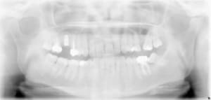 Xxx2 bmbs2m - Eugenol