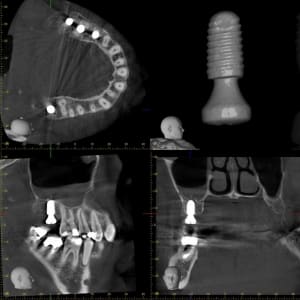 Xyzview 20151217 134 hby6nd - Eugenol