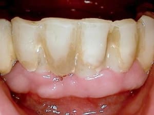 Zwp 9 aa5ufk - Eugenol