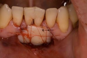  mg 0059 jpplt9 - Eugenol