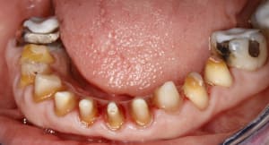  mg 0736 prtmyz - Eugenol