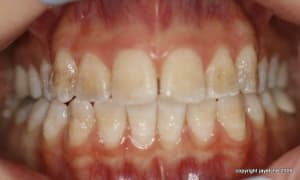  mg 1778 e0bxab - Eugenol