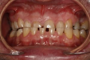  mg 1814  1024x768  gb3cgi - Eugenol