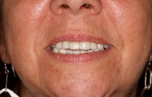  mg 1950 jggak3 - Eugenol