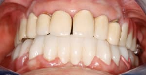  mg 2176 xte3dg - Eugenol