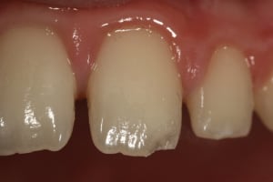  mg 7390 x3iit2 - Eugenol