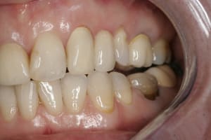 mg 8010 zk4wb2 - Eugenol