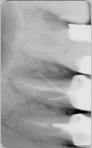 A trs95z - Eugenol