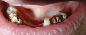 A xhdmjl - Eugenol
