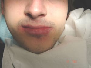 Ac1 axudnd - Eugenol