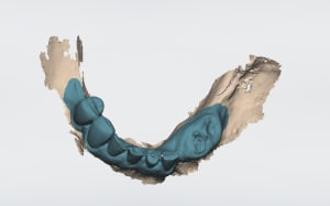 Aexmfhbqwqgzjhgwfrxa - Eugenol