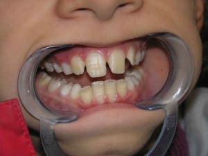 Amelo imp 2 lxnce4 - Eugenol