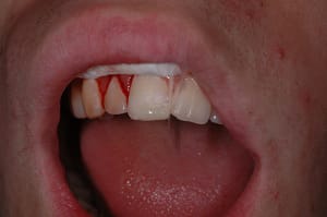 Angletemp hyfdzw - Eugenol