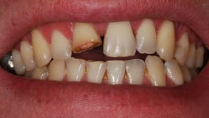 Argh dgbbe4 - Eugenol