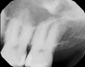 Auojeqkgwsbryhshnyza - Eugenol