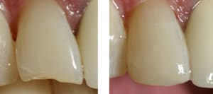 Av ap 12 miris 200ko g9tuth - Eugenol