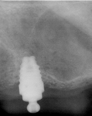 Avant txm6kh - Eugenol