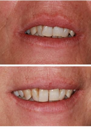 Avap3 jlxnb5 - Eugenol