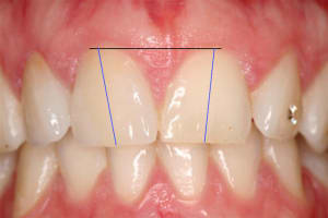 Axe px06qo - Eugenol