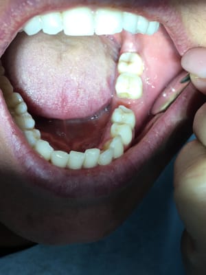 B49u8tpitwzeu3maztxq - Eugenol
