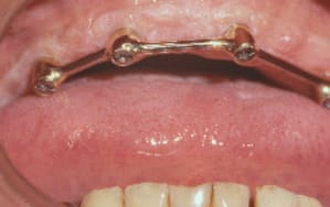 Barre haut03 ccn5bi - Eugenol