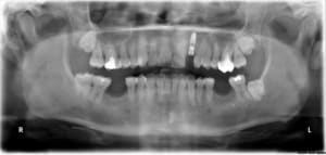 Bo4 x7unrb - Eugenol