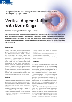 Bone ring adnimm - Eugenol