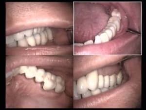 Bridge d o2pswn - Eugenol