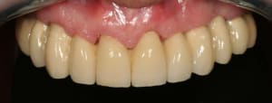 Bridge fini j1aaz5 - Eugenol