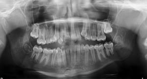Canine mal barr e owqg3t - Eugenol