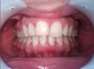 Cas1 kveeys - Eugenol