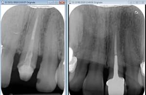 Ceram ifnwjp - Eugenol