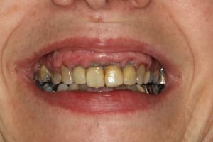 Championnat cj9m5m - Eugenol