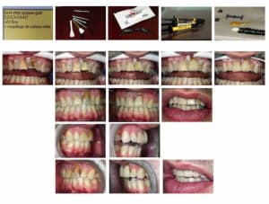 Chris facette recap web ma9hrw - Eugenol