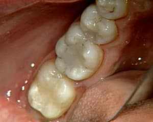 Compo finis cx3d87 - Eugenol