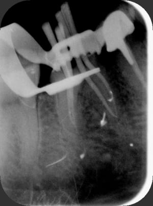 Cone woiqgq - Eugenol