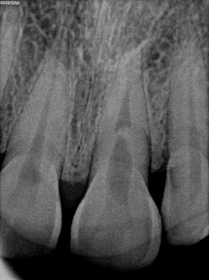 Ct9xduyv7kar5lvgdnl7 - Eugenol