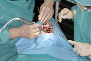 Déoulé d une mci dr r - Eugenol