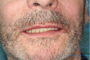 Déoulé d une mci dr r - Eugenol