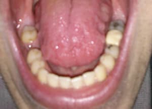 D ek51fw - Eugenol