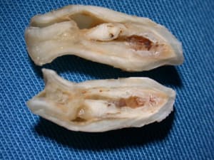 D usm3ir - Eugenol