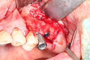 Dave 007 cuwuib - Eugenol