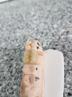 Dent4 amcmr5 - Eugenol